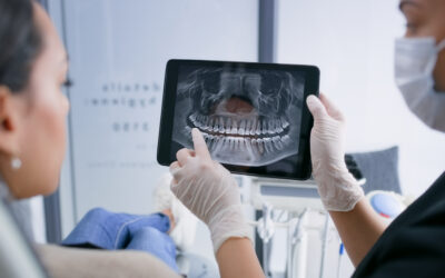 The Importance of Dental Radiographs